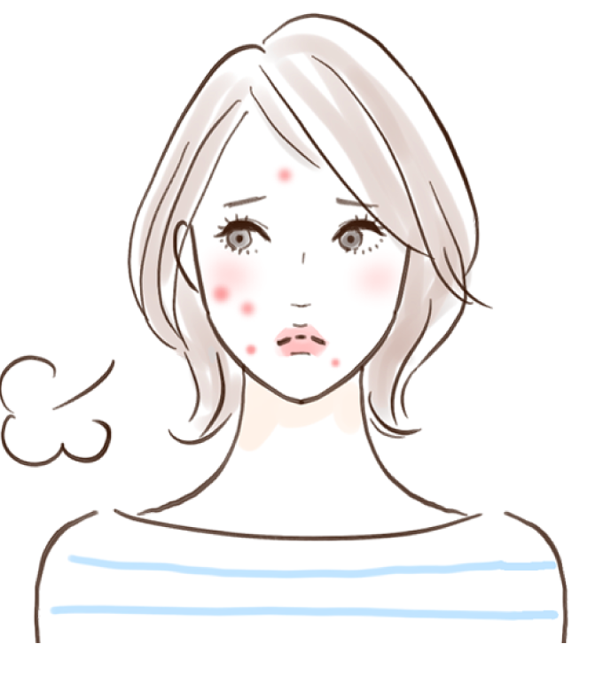 肌荒れやニキビで悩む女性