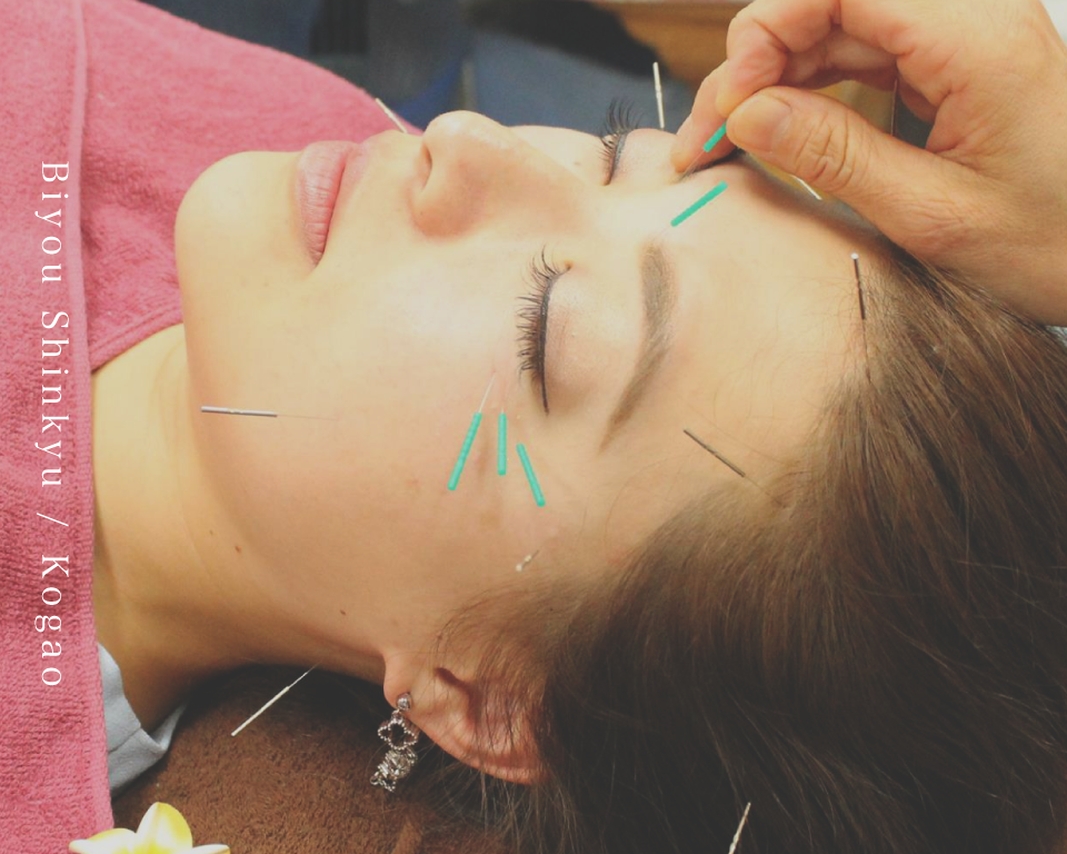 梅田・西天満の鍼灸院・美容鍼灸サロン【プティ・エシェル】の美容鍼・小顔矯正施術写真